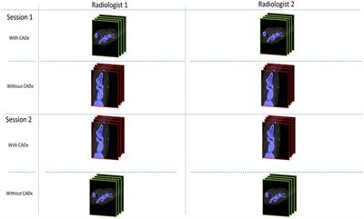 Deep-learning for automated detection of MSU deposits on DECT: evaluating impact on efficiency and reader confidence